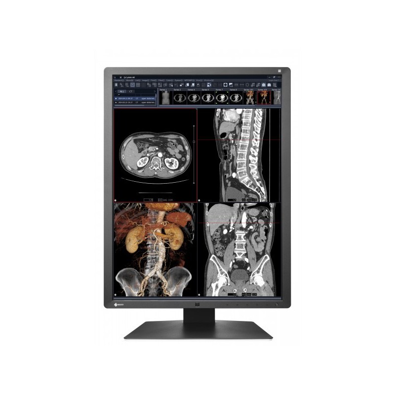 Eizo RadiForce RX250