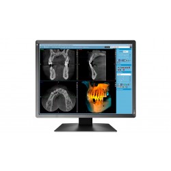 Eizo RadiForce MX216-SB