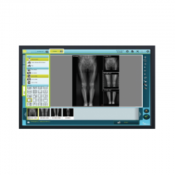 DR TECH EVS 3643/4343 + MED X-RAY