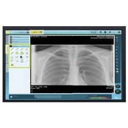 advanced digital radiology pack