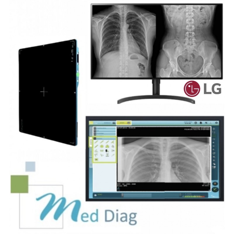 Pack Radiologie numérique avancée