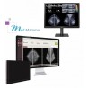 Pack mammographie numérique