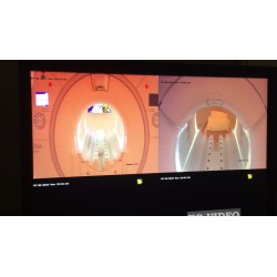 MRI surveillance camera set including monitor