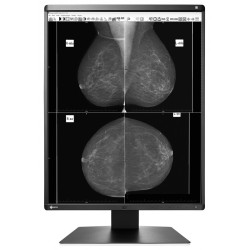 EIZO RadiForce GX560 / GX560-MD