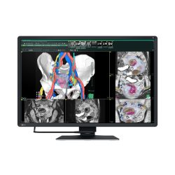 Eizo RadiForce RX670