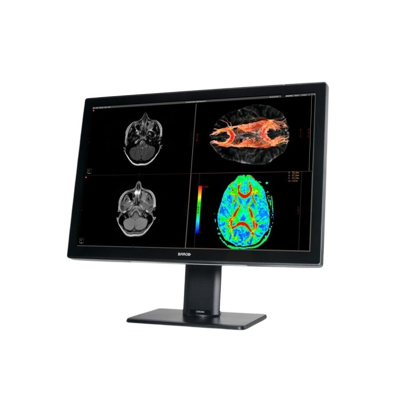 Barco Coronis Fusion 6MP (MDCC-6530)